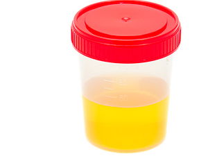 La orina sustituye al enchufe para recargar el móvil