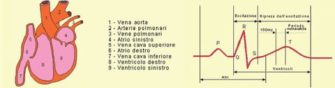 Fibrillazione ventricolare