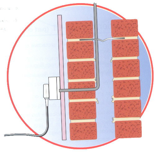 Snag 18 - Cables in cavity walls - Thermoplastic (pvc) insulated and sheathed cables should, normally, not be installed in external cavity walls.